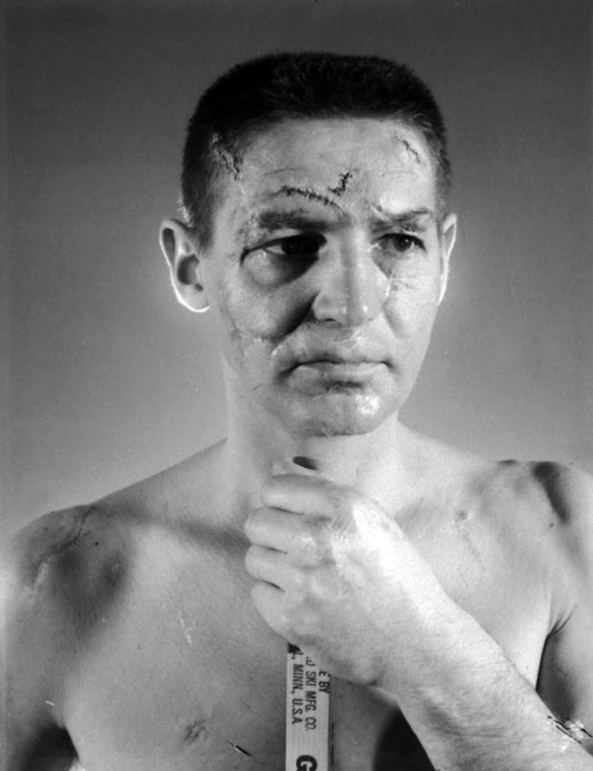 Terry Sawchuk - The face of a hockey goalie before masks became standard game equipment, 1966